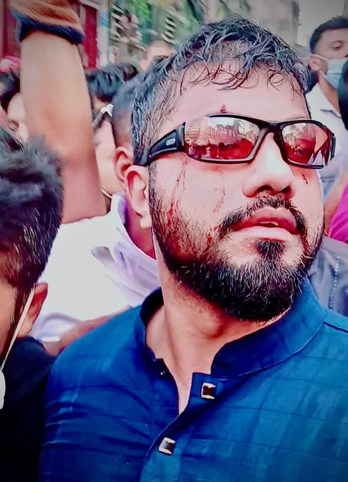 “রাজপথ’ই হবে অন্তিম ঠিকানা ইনশাল্লাহ”- ইশরাক হোসেন”