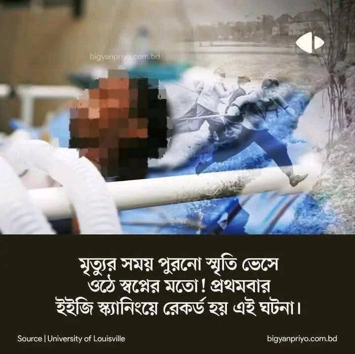 “ইইজি স্ক্যান চলাকালীন মারা যান পেশেন্ট।”