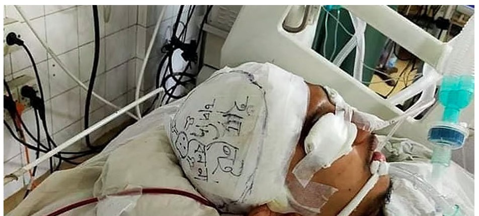 “মেডিকেল ছাত্র আকিব কেমন আছে”