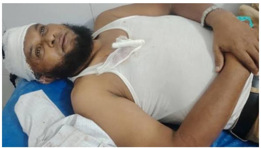 মাদকবিরোধী অভিযানে পুলিশের ওপর হামলা, গ্রেপ্তার ৩