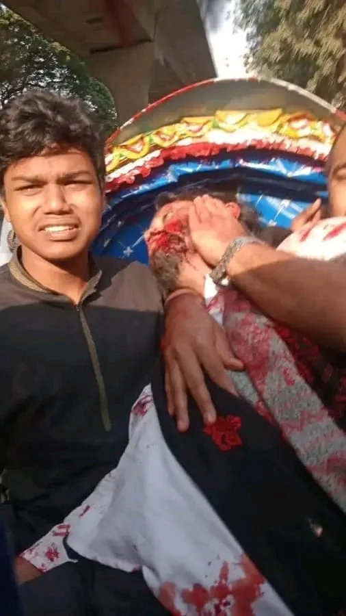 ওসমান হাদি গুলিবিদ্ধ। নেয়া হয়েছে ঢামেকে।